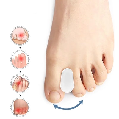 Tåspreder til hallux valgus - 2 stk. - Adskiller tæerne for at reducere smerte